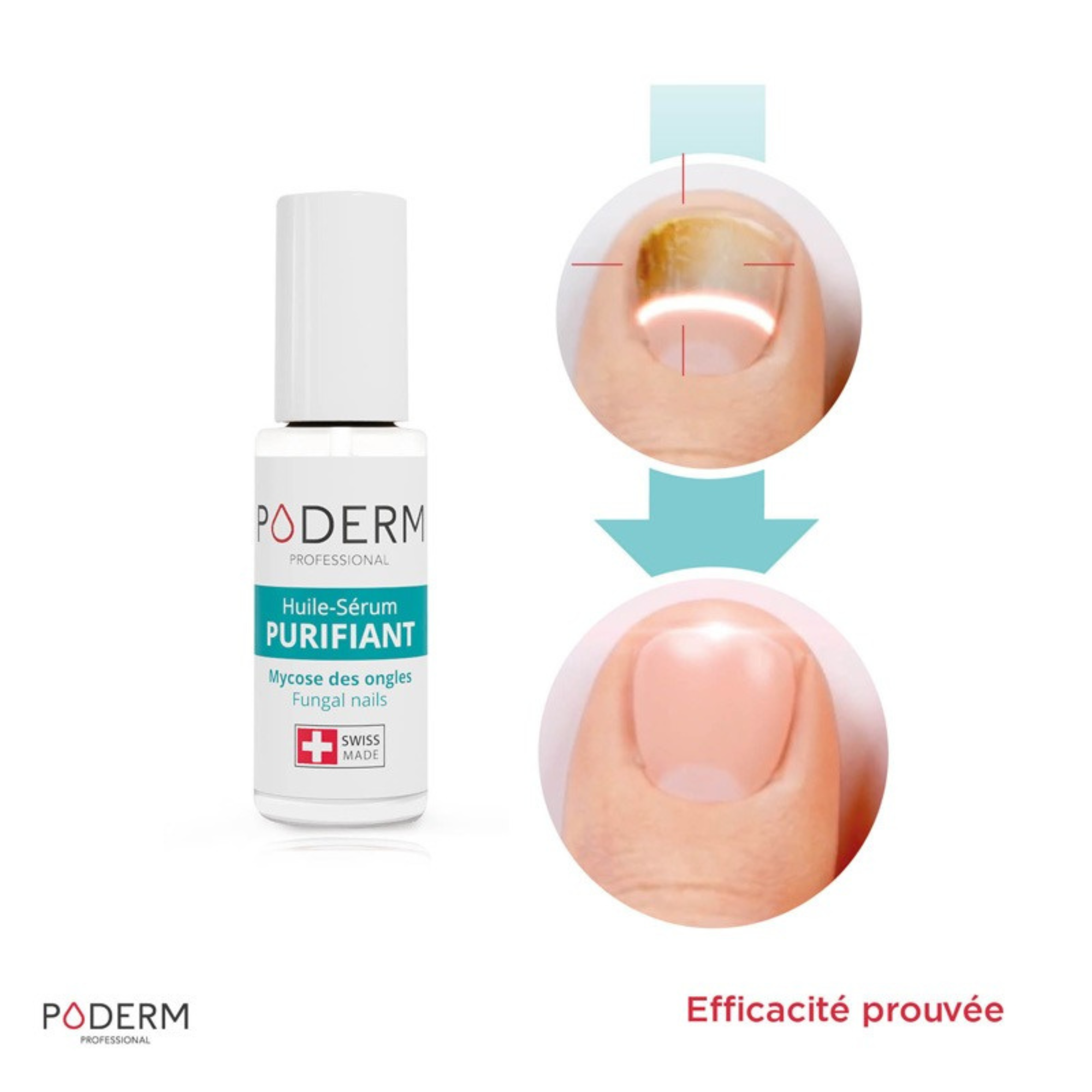 Pack Traitement Sérum Purifiant (8 ml) + Booster (6 ml) - Poderm Professional