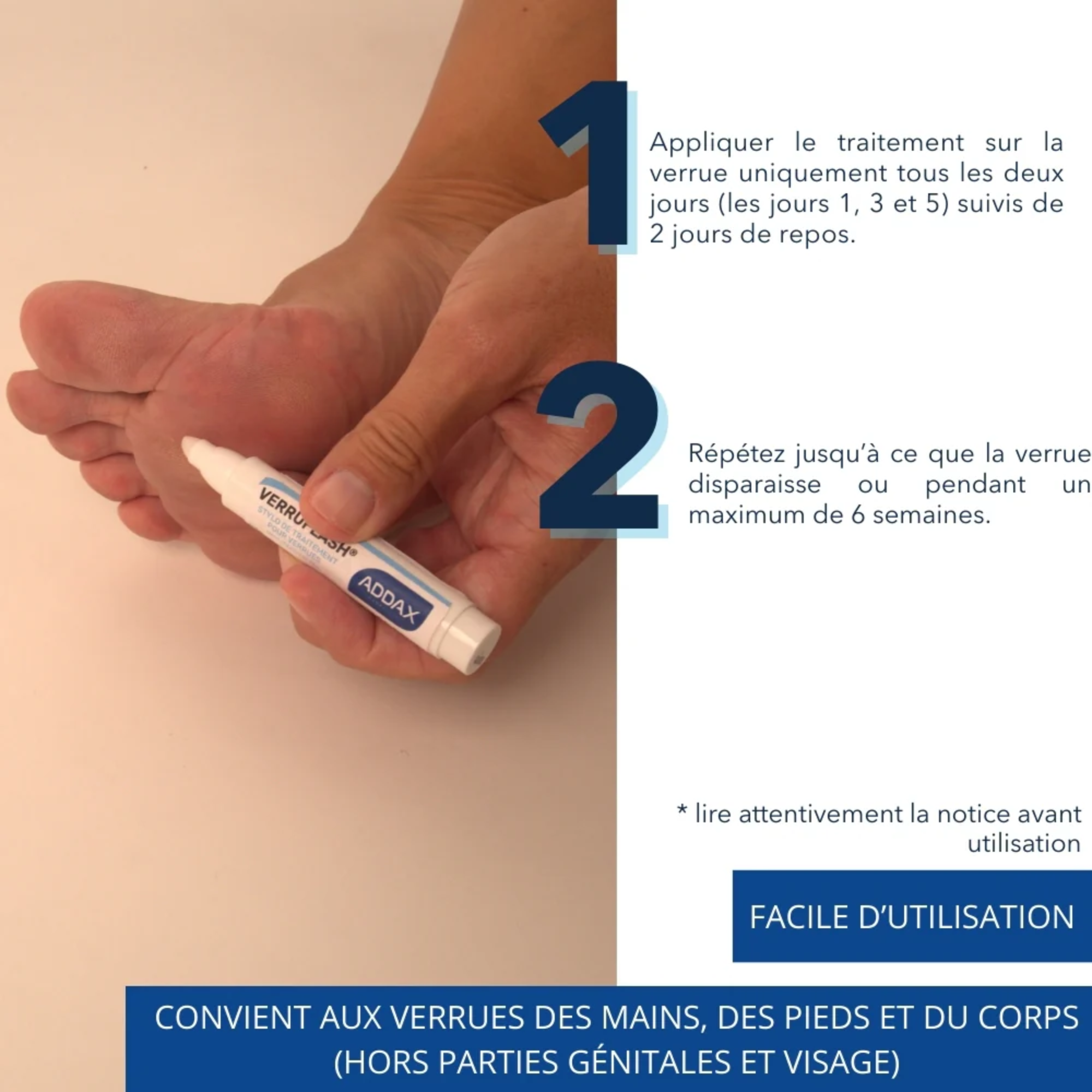 VERRUFLASH® Stylo - Traitement Verrues mains, pieds et corps - 3 ml - Laboratoire Addax Laboratoire Addax