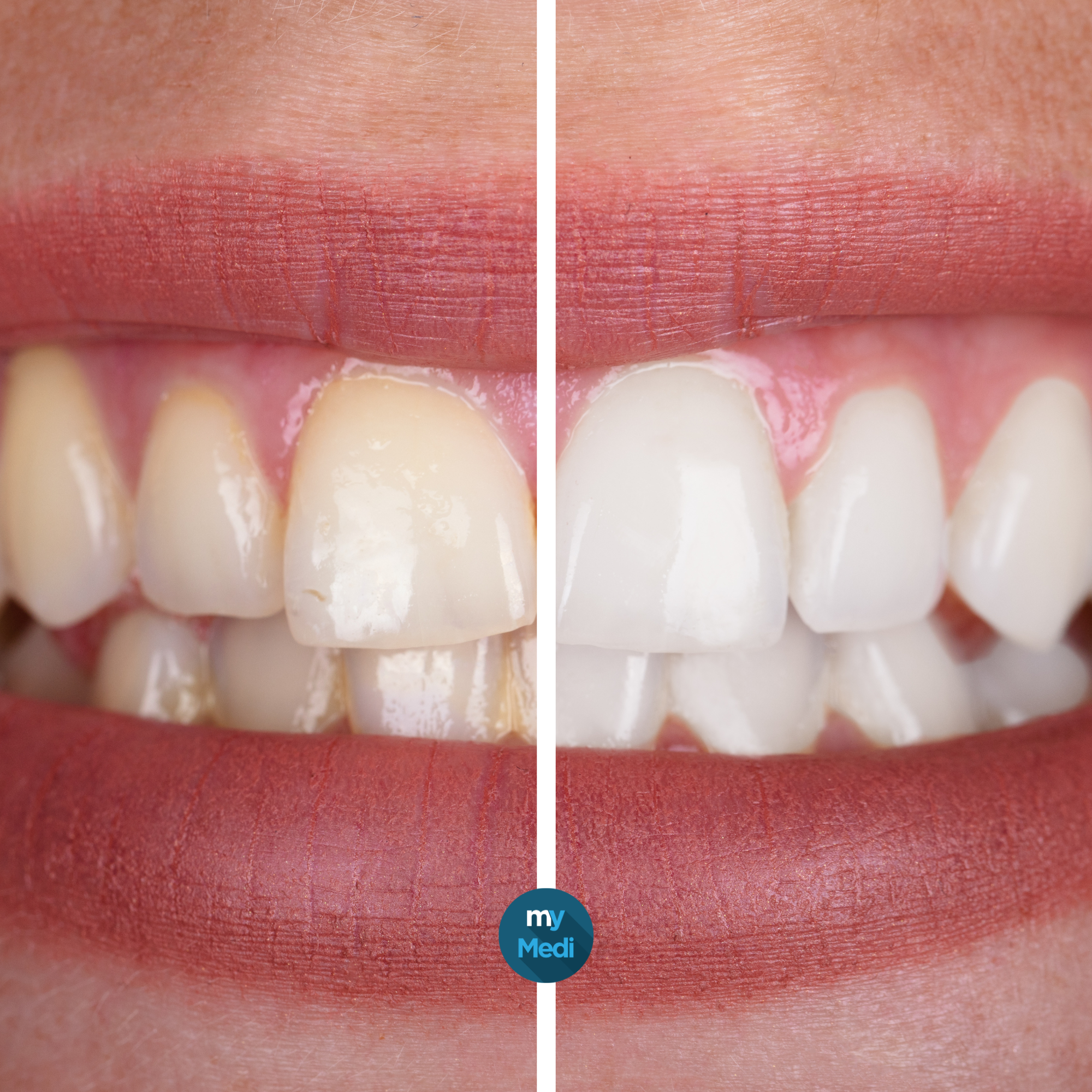 Restauration et esthétique