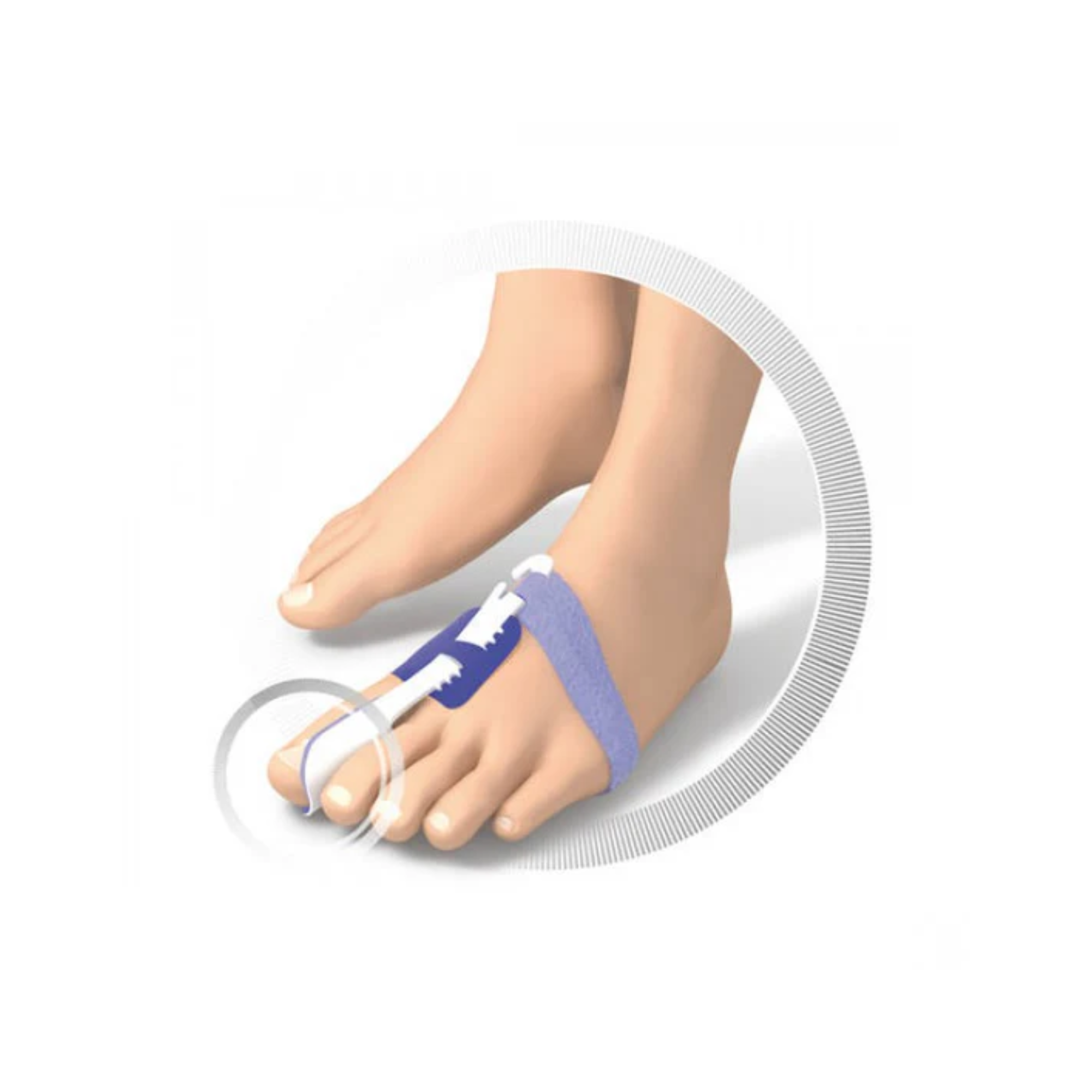 Nocturnal Hallux Valgus restraint - Ruck