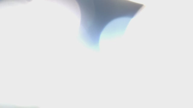 Charger la vidéo : Lampe d'examen Visiano 20 Derungs - 60 000 lux - Waldmann